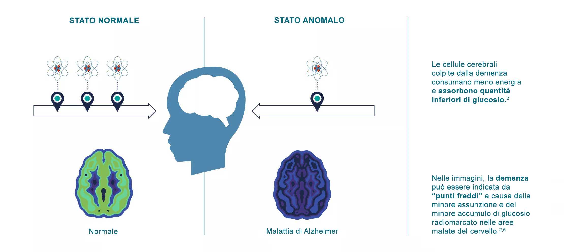 Imaging dementia-it