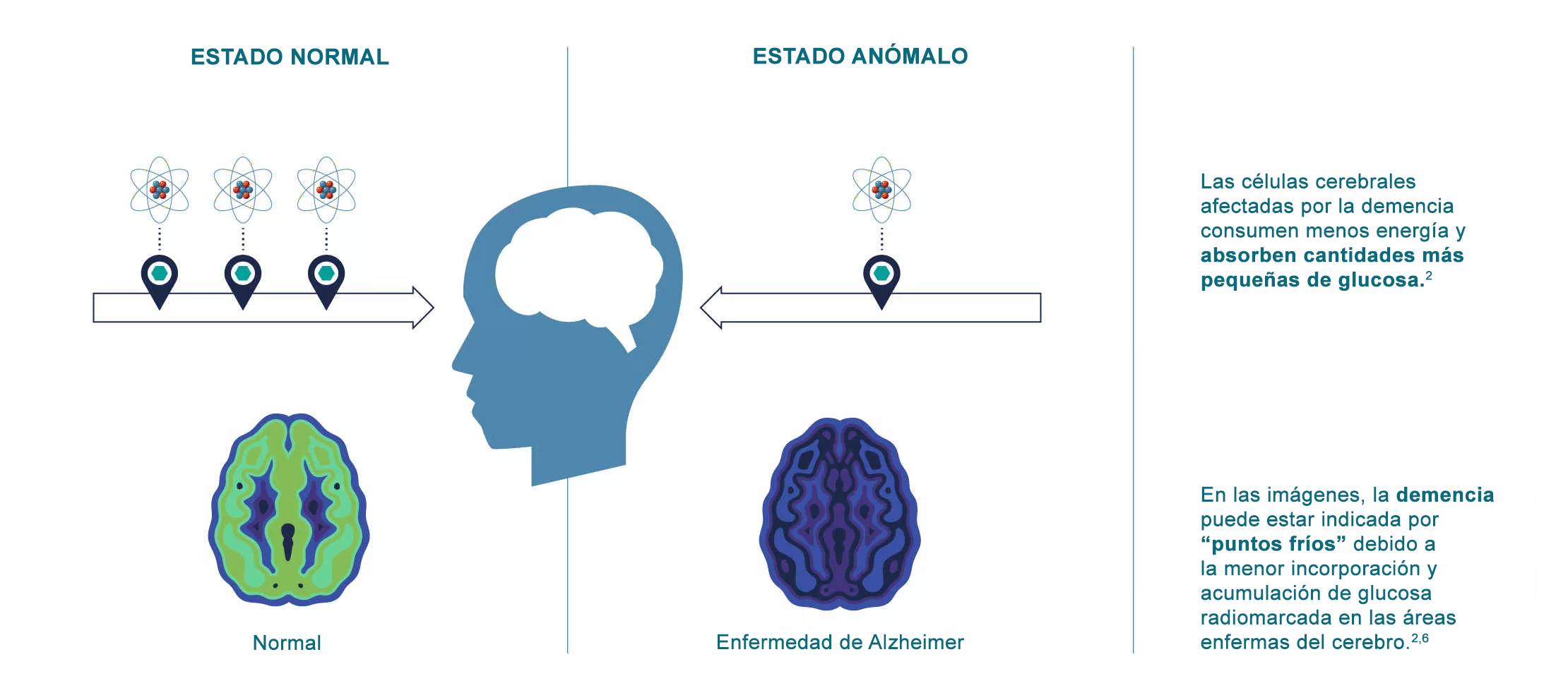 Imaging dementia-es