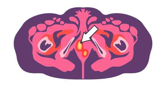 (A) Nuclear Medicine Scan