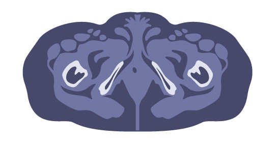 (B) CT scan