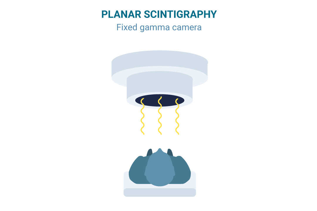 PLANAR SCINTIGRAPHY