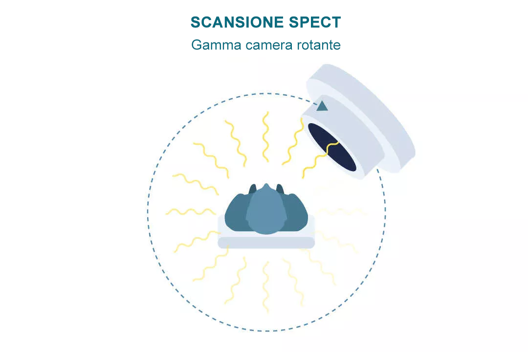 SPECT SCAN-it