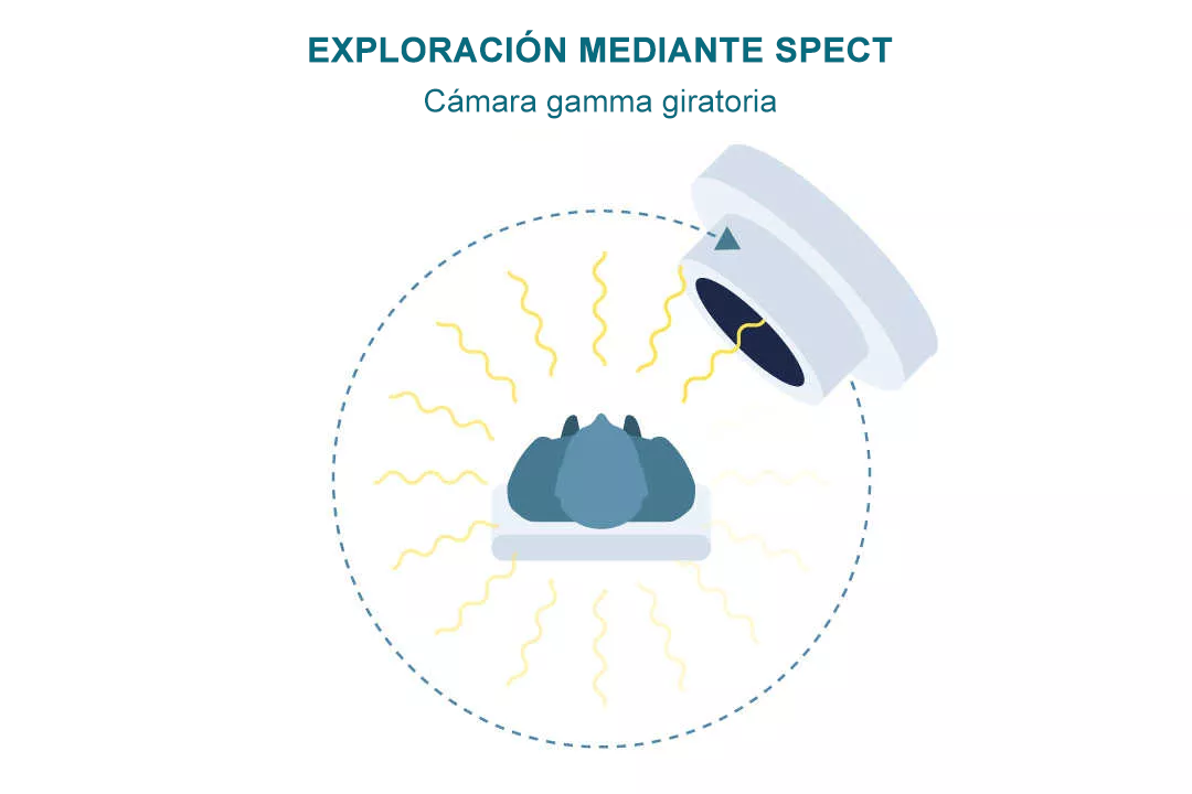 SPECT SCAN-es