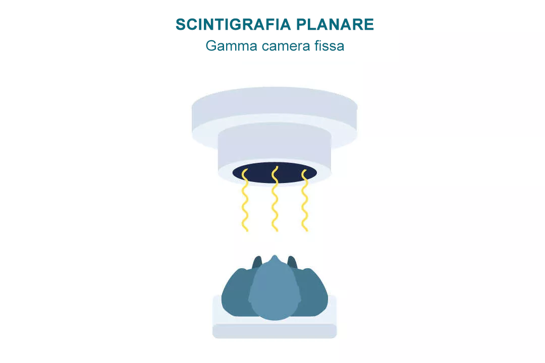 PLANAR SCINTIGRAPHY-it