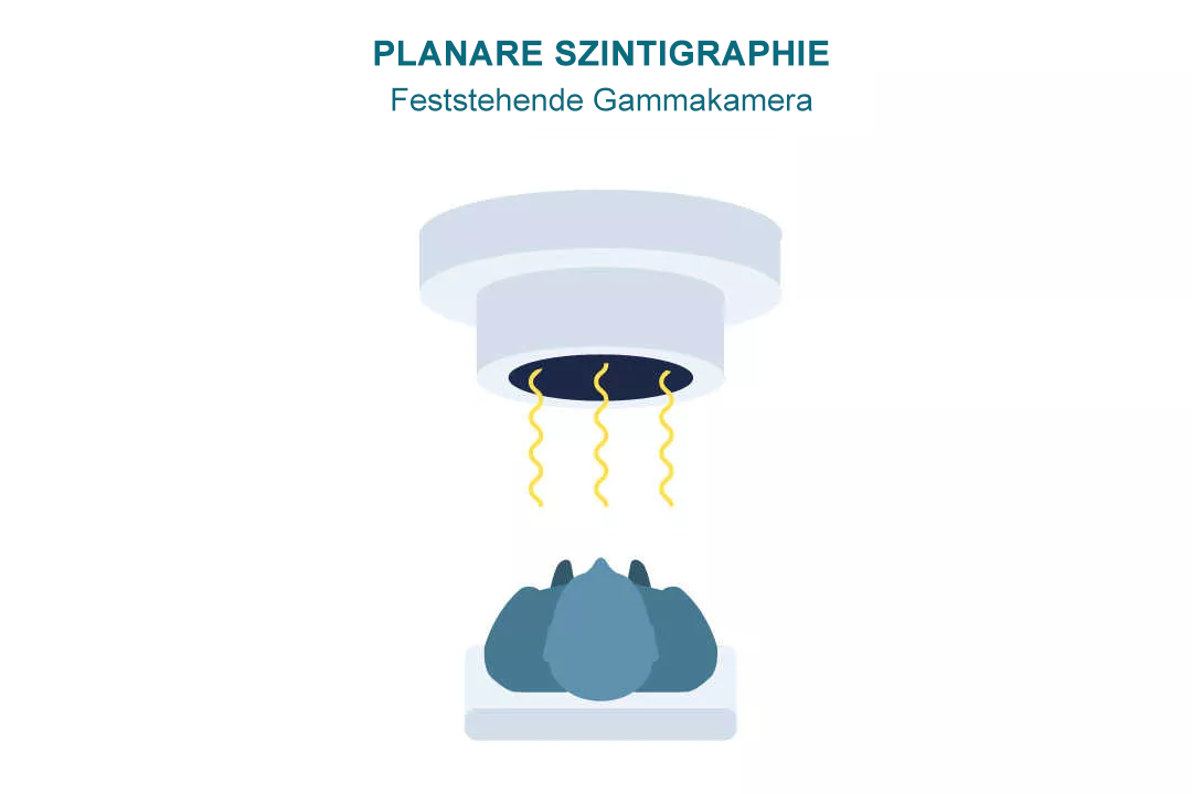 PLANAR SCINTIGRAPHY-de