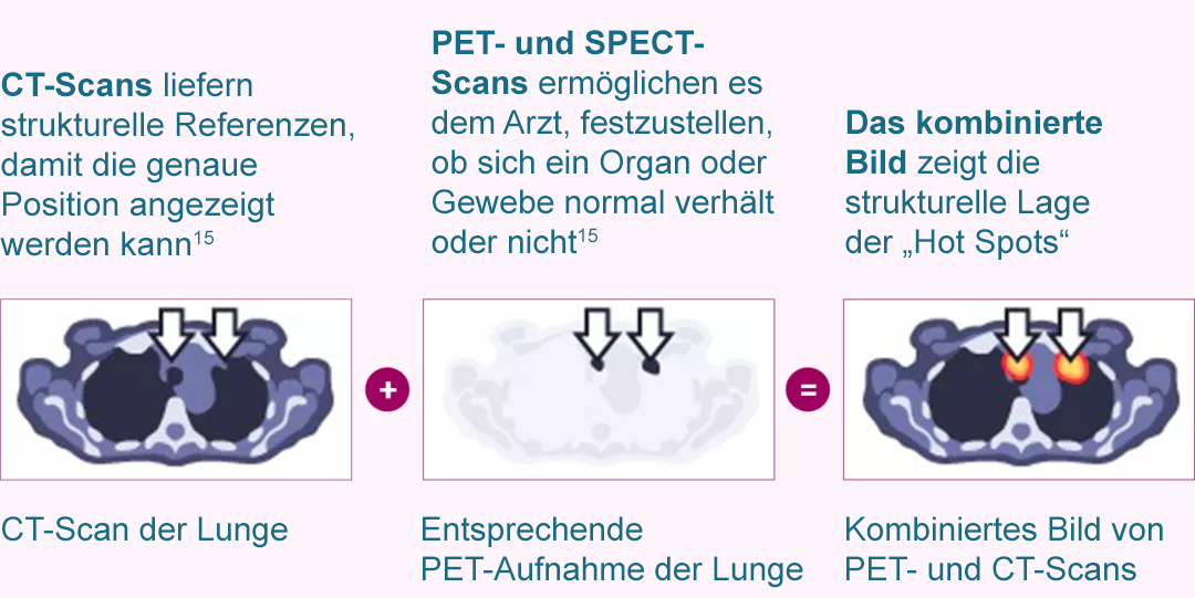CT Scan-de