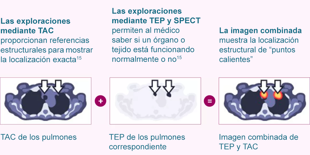 CT Scan-es