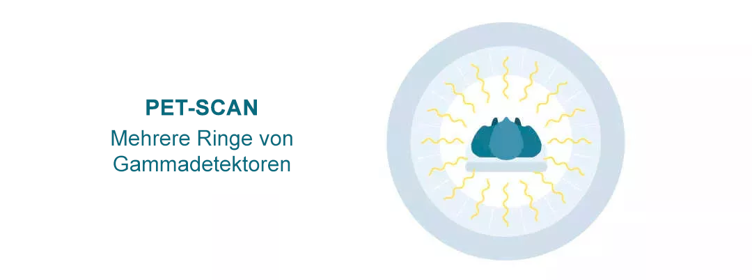 Types of nuclear medicine scan-de