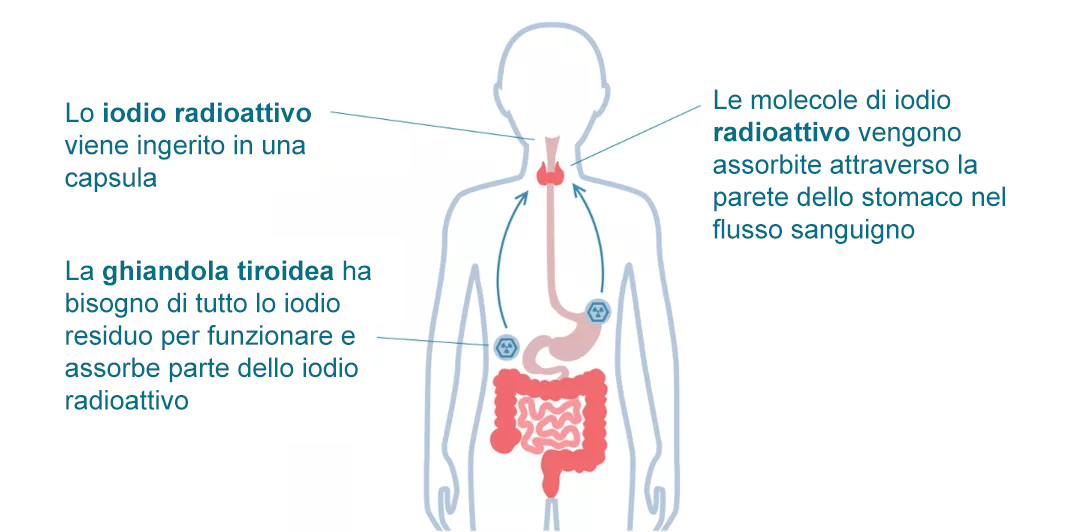 Nuclear Medicine Therapy-it
